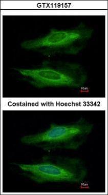 Anti-HECA antibody [C1C3] used in ICC/IF. GTX119157