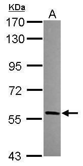 Anti-HECA antibody [C1C3] used in Western blot. GTX119157
