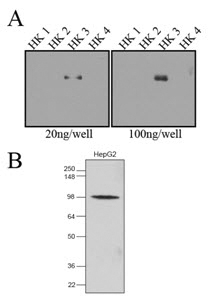 Anti-Hexokinase 3 antibody [4F5] used in Western blot. GTX50057