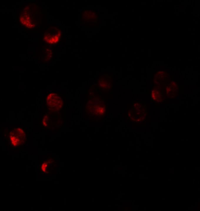 Anti-HIG1 antibody used in ICC/IF. GTX16279