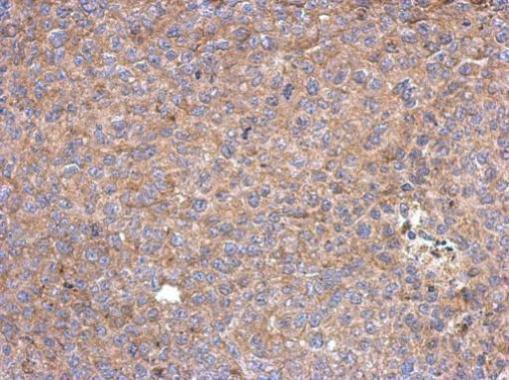 Anti-HISPPD1 antibody [N1N2], N-term used in IHC (Formalin-fixed paraffin-embedded sections). GTX111614