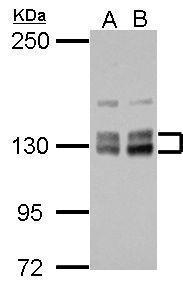 Anti-HISPPD1 antibody [N1N2], N-term used in Western blot. GTX111614