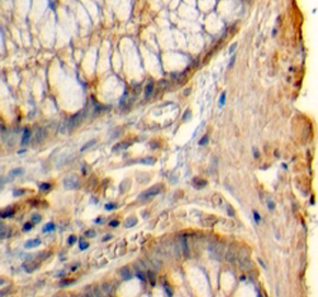 Anti-Histamine Receptor H1 antibody, C-term used in IHC (Formalin-fixed paraffin-embedded sections). GTX89495
