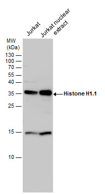 Anti-Histone H1.1 antibody used in Western blot. GTX117055