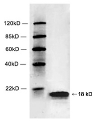 Anti-Histone H2B antibody used in Western blot. GTX21790