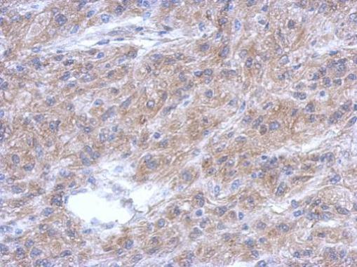 Anti-ALS2CR12 antibody used in IHC (Formalin-fixed paraffin-embedded sections). GTX120076