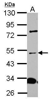 Anti-ALS2CR15 antibody used in Western blot. GTX120861