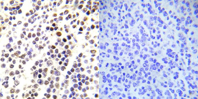 Anti-Histone H3S28ph (phospho Ser28) antibody used in IHC (Formalin-fixed paraffin-embedded sections). GTX79053