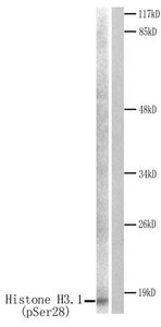 Anti-Histone H3S28ph (phospho Ser28) antibody used in Western blot. GTX79053
