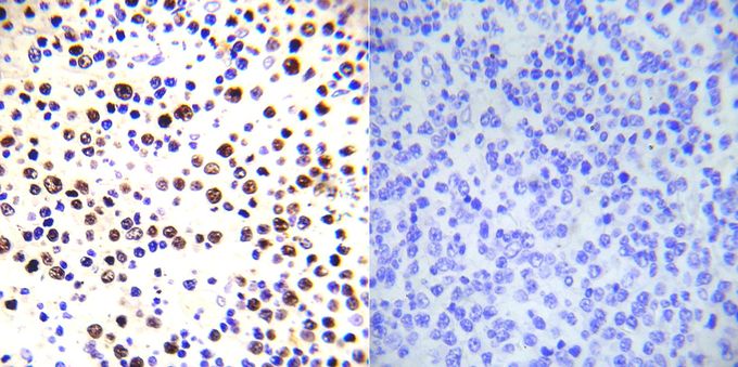 Anti-Histone H3T3ph (phospho Thr3) antibody used in IHC (Formalin-fixed paraffin-embedded sections). GTX79055