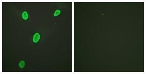 Anti-Histone H4K12ac (acetyl Lys12) antibody used in ICC/IF. GTX88003
