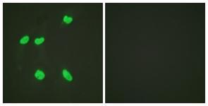 Anti-Histone H4K16ac (acetyl Lys16) antibody used in ICC/IF. GTX88004