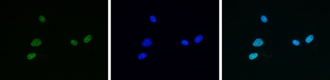 Anti-Histone H4K5K8K12K16ac (acetyl Lys5/Lys8/Lys12/Lys16) antibody - ChIP grade used in ICC/IF. GTX60334