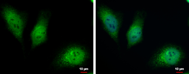 Anti-HKDC1 antibody used in ICC/IF. GTX111506
