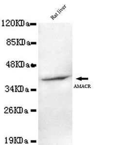 Anti-AMACR antibody [2F3-C11-B12] used in Western blot. GTX49217