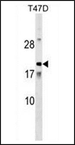 Anti-Amelotin antibody used in Western blot. GTX53502