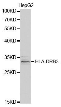 Anti-HLA-DRB3 antibody used in Western blot. GTX54087