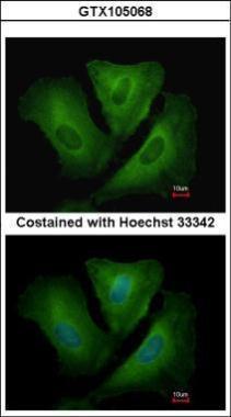 Anti-HLA-DRB3 antibody used in ICC/IF. GTX105068