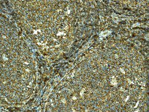 Anti-HLA-F antibody [EPR6803] used in Immunohistochemistry. GTX63761