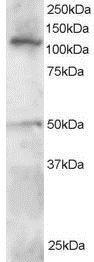 Anti-HLTF antibody, C-term used in Western blot. GTX89908