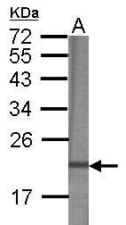 Anti-AMOTL2 antibody [C1C3] used in WB-Ag. GTX120057