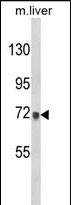 Anti-AMOTL2 antibody, Internal used in Western blot. GTX80977