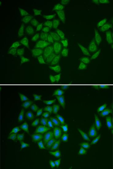 Anti-AMPD3 antibody used in ICC/IF. GTX30046