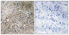 Anti-A26C2/3 antibody used in IHC (Formalin-fixed paraffin-embedded sections). GTX87210
