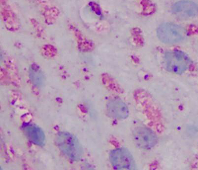 Anti-ANAPC1 antibody used in Immunohistochemistry. GTX85699