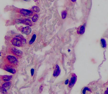 Anti-ANAPC1 antibody used in Immunohistochemistry. GTX85699