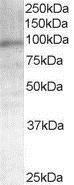 Anti-Androgen Receptor antibody, N-term used in Western blot. GTX19066