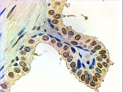 Anti-Androgen Receptor antibody, N-term used in IHC (Formalin-fixed paraffin-embedded sections). GTX19066