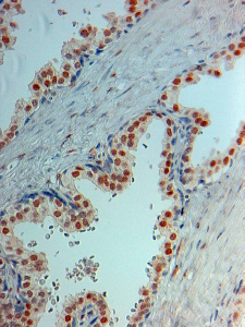 Anti-Androgen Receptor antibody, N-term used in IHC (Formalin-fixed paraffin-embedded sections). GTX19066
