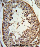Anti-ANGEL1 antibody, C-term used in IHC (Formalin-fixed paraffin-embedded sections). GTX80925