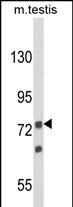 Anti-ANGEL1 antibody, C-term used in Western blot. GTX80925