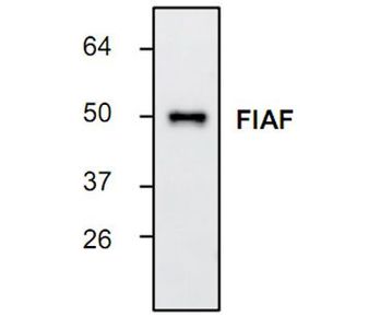 Anti-Angiopoietin-like 4 antibody used in Western blot. GTX16270