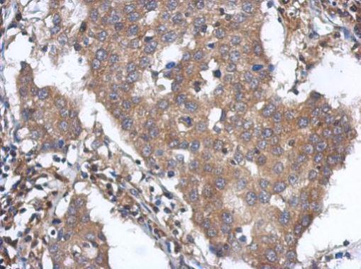 Anti-ANKLE2 antibody [N1N3] used in IHC (Formalin-fixed paraffin-embedded sections). GTX120698