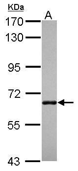 Anti-ANKRD13B antibody [N2C2], Internal used in Western blot. GTX120713
