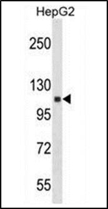 Anti-ANKRD18A antibody used in Western blot. GTX53506