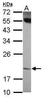 Anti-ANKRD39 antibody [N1C3] used in Western blot. GTX120277
