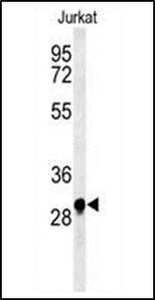 Anti-ANKRD49 antibody used in Western blot. GTX53524