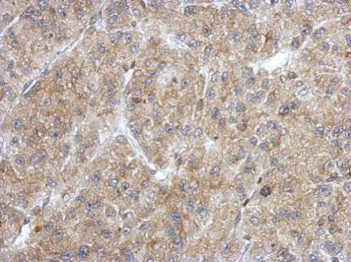 Anti-ANKRD53 antibody used in IHC (Formalin-fixed paraffin-embedded sections). GTX123019