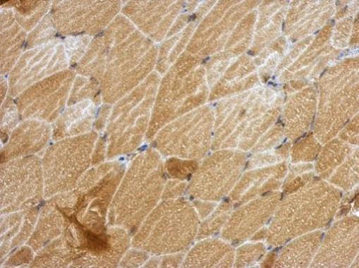 Anti-ANKRD53 antibody used in IHC (Formalin-fixed paraffin-embedded sections). GTX123019