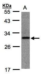 Anti-ANKRD7 antibody [N1C3] used in Western blot. GTX106843