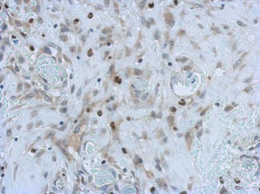 Anti-ANKS3 antibody [N2C1], Internal used in IHC (Formalin-fixed paraffin-embedded sections). GTX119835