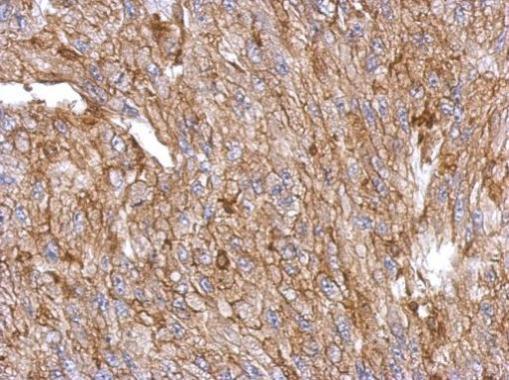 Anti-Annexin III antibody used in IHC (Formalin-fixed paraffin-embedded sections). GTX103330