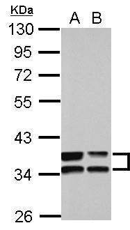 Anti-Annexin III antibody used in Western blot. GTX103330