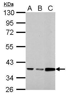 Anti-Annexin III antibody used in Western blot. GTX114253