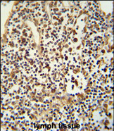 Anti-ANO5 antibody, C-term used in IHC (Formalin-fixed paraffin-embedded sections). GTX81161