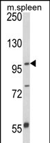 Anti-ANO5 antibody, C-term used in Western blot. GTX81161